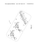 Anchor Deployment for Implantable Medical Devices diagram and image