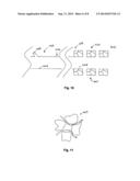 Implantable Device With Adhesive Properties diagram and image