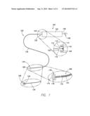 TEMPORARY LEADLESS IMPLANTABLE MEDICAL DEVICE WITH INDWELLING RETRIEVAL     MECHANISM diagram and image