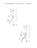 TEMPORARY LEADLESS IMPLANTABLE MEDICAL DEVICE WITH INDWELLING RETRIEVAL     MECHANISM diagram and image