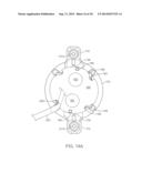 Recessed Burr Hole Covers and Methods for Using the Same diagram and image