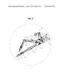 LAPAROSCOPIC SURGICAL DEVICES HAVING WIRE REDUCER diagram and image