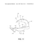 TISSUE ANCHOR WITH INSERTION DEVICE diagram and image