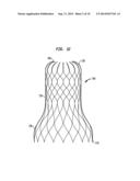 PMVR CLIP CONFIGURATIONS FOR MITRAL LEAFLET diagram and image