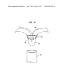 PMVR CLIP CONFIGURATIONS FOR MITRAL LEAFLET diagram and image