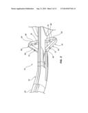 THREE SUTURE LARGE BORE CLOSURE DEVICE AND METHODS diagram and image