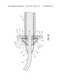 THREE SUTURE LARGE BORE CLOSURE DEVICE AND METHODS diagram and image