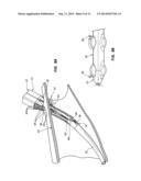 THREE SUTURE LARGE BORE CLOSURE DEVICE AND METHODS diagram and image