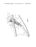 THREE SUTURE LARGE BORE CLOSURE DEVICE AND METHODS diagram and image