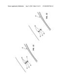 THREE SUTURE LARGE BORE CLOSURE DEVICE AND METHODS diagram and image