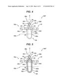 Implant Having Adjustable Filament Coils diagram and image