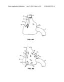 METHODS AND APPARATUS FOR REVISION OF OBESITY PROCEDURES diagram and image