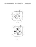 METHODS AND APPARATUS FOR REVISION OF OBESITY PROCEDURES diagram and image