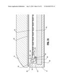 SURGICAL DEVICE diagram and image