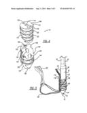 Knotless Suture Anchor And Method Of Using Same diagram and image