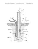 Knotless Suture Anchor And Method Of Using Same diagram and image