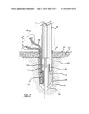 Knotless Suture Anchor And Method Of Using Same diagram and image