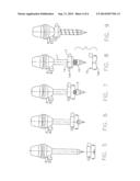 Trocar Support diagram and image