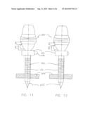 Trocar Support diagram and image