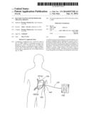 BALLOON SYSTEM AND METHODS FOR TREATING OBESITY diagram and image