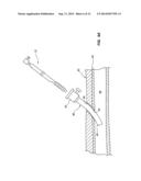 TEMPORARY SEALING DEVICE WITH BLOOD FLASHBACK FOR VESSEL LOCATION diagram and image