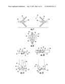 MEDICAL DEVICE FOR TREATING A TARGET SITE diagram and image