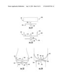 MEDICAL DEVICE FOR TREATING A TARGET SITE diagram and image