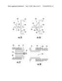 MEDICAL DEVICE FOR TREATING A TARGET SITE diagram and image