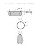 FILTERING AND REMOVING PARTICULATES FROM BLOODSTREAM diagram and image