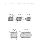 FILTERING AND REMOVING PARTICULATES FROM BLOODSTREAM diagram and image