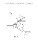 MICRO-FABRICATED EMBOLIC DEVICES diagram and image