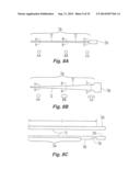 Embolus Blood Clot Filter Delivery System diagram and image