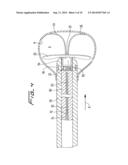 CLOSURE DEVICE FOR LEFT ATRIAL APPENDAGE diagram and image