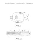 CLOSURE DEVICE FOR LEFT ATRIAL APPENDAGE diagram and image