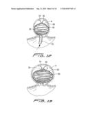 CLOSURE DEVICE FOR LEFT ATRIAL APPENDAGE diagram and image