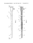 DISTAL RAPID EXCHANGE FOR TRANSLUMINAL ANGIOPLASTY DEVICE AND METHODS diagram and image