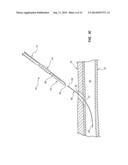 DISTAL RAPID EXCHANGE FOR TRANSLUMINAL ANGIOPLASTY DEVICE AND METHODS diagram and image