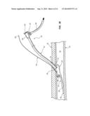 DISTAL RAPID EXCHANGE FOR TRANSLUMINAL ANGIOPLASTY DEVICE AND METHODS diagram and image