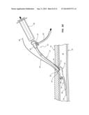 DISTAL RAPID EXCHANGE FOR TRANSLUMINAL ANGIOPLASTY DEVICE AND METHODS diagram and image