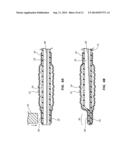 DISTAL RAPID EXCHANGE FOR TRANSLUMINAL ANGIOPLASTY DEVICE AND METHODS diagram and image