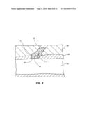 ACTIVE SECUREMENT DETACHABLE SEALING TIP FOR EXTRA-VASCULAR CLOSURE DEVICE     AND METHODS diagram and image