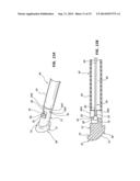 ACTIVE SECUREMENT DETACHABLE SEALING TIP FOR EXTRA-VASCULAR CLOSURE DEVICE     AND METHODS diagram and image