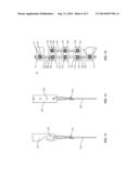 SPINAL CORRECTION SYSTEM AND METHOD diagram and image