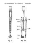 Device and Method For Implanting A Spinous Process Fixation Device diagram and image