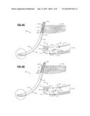 PERCUTANEOUS ROD INSERTER diagram and image