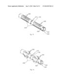 SHAPE CHANGING BONE IMPLANT AND METHOD OF USE FOR ENHANCING HEALING diagram and image