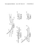 ELECTRODE HAVING ERECTABLE LEAD diagram and image