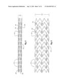 MEDICAL DEVICE UTILIZING A NICKEL-TITANIUM TERNARY ALLOY HAVING HIGH     ELASTIC MODULUS diagram and image