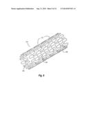 MEDICAL DEVICE UTILIZING A NICKEL-TITANIUM TERNARY ALLOY HAVING HIGH     ELASTIC MODULUS diagram and image