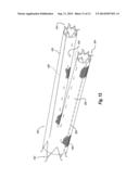 MEDICAL DEVICE UTILIZING A NICKEL-TITANIUM TERNARY ALLOY HAVING HIGH     ELASTIC MODULUS diagram and image